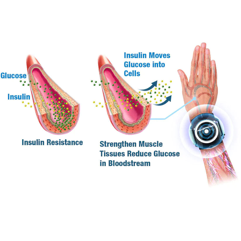 Cel mai recent dispozitiv electric cu impulsuri GlycoWave